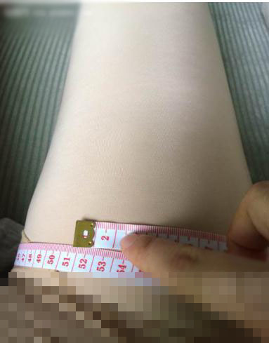 大腿環(huán)吸脂