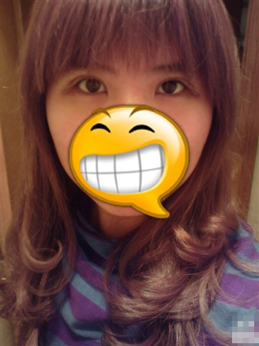 雙眼皮