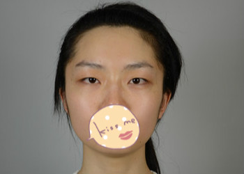 術前樣子