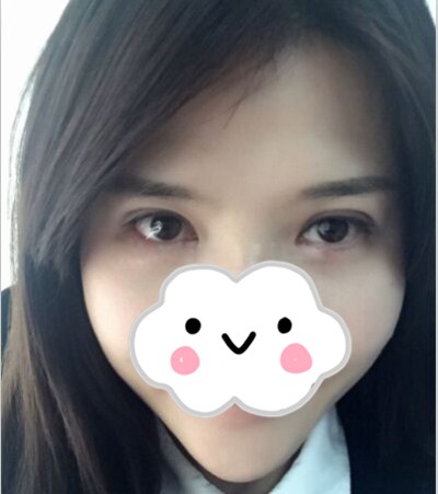 術(shù)后第七天