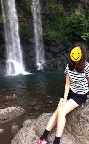 大腿吸脂