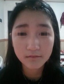做了挺鼻子，人生完美了！