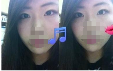 割雙眼皮，讓我擁有了美麗的大眼