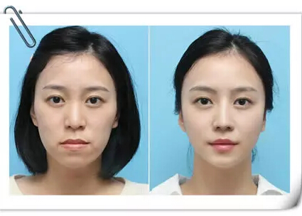 整形手术麻醉 整形手术麻醉