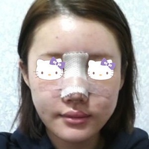 術(shù)后第二天