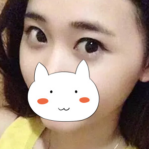 雙眼皮手術(shù)前