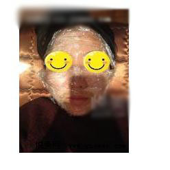 激光美白 真的白了