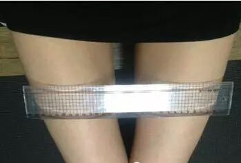 大腿吸脂術(shù)后