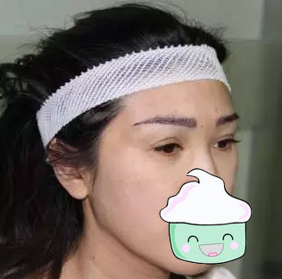 眉毛種植術后