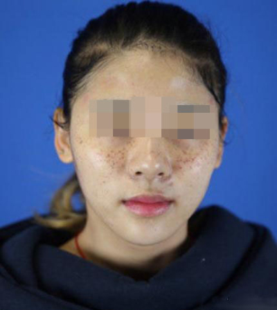 要跟斑女郎說拜拜了