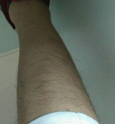 脫腿毛