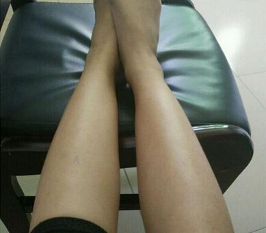 脫腿毛效果