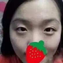 手術(shù)前