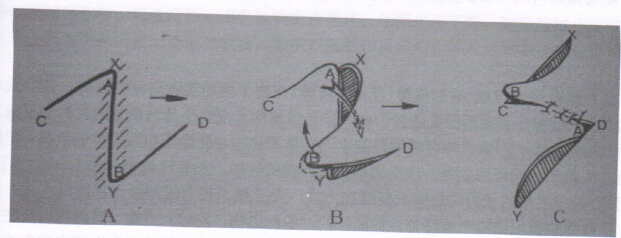 图3 “Z”成形