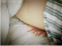大小腿吸脂，讓我越來越愛自拍了