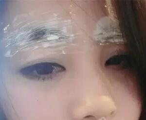 上麻藥
