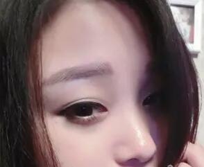 紋眉術(shù)后的樣子