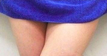 大腿吸脂前