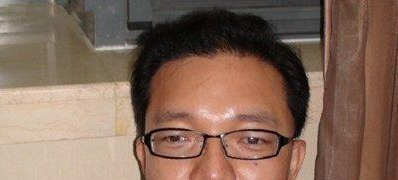 植發(fā)的效果圖