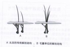 圖2頭發(fā)的傳統(tǒng)解剖結(jié)構(gòu)與毛囊單位的解剖結(jié)構(gòu)對(duì)比