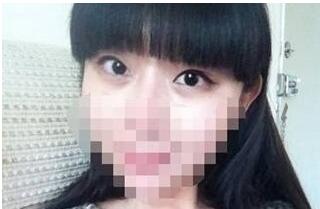 手術后45天
