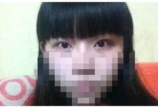 手術后22天