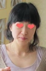 隆鼻手術(shù)，果然沒辜負我的六萬大洋