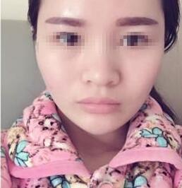 紋眉