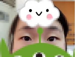 雙眼皮術(shù)前