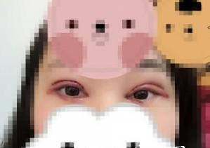 睜眼
