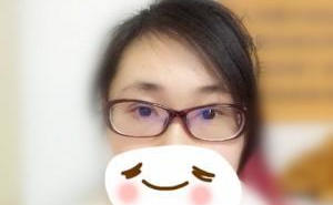 雙眼皮