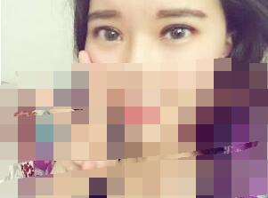 雙眼皮