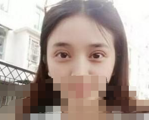 開內(nèi)眼角