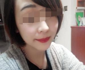 隆下巴案例