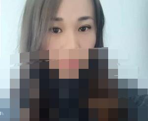 埋線雙眼皮效果