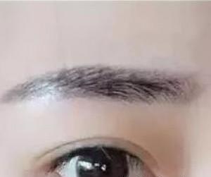 紋眉術(shù)后