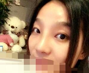 隆鼻效果