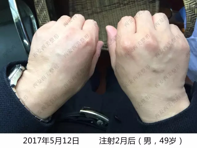 纖纖玉手