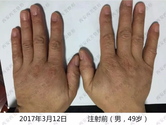 纖纖玉手