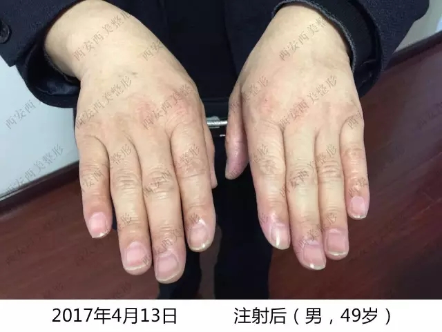 纖纖玉手