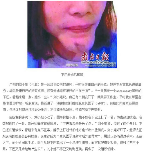 生長(zhǎng)因子