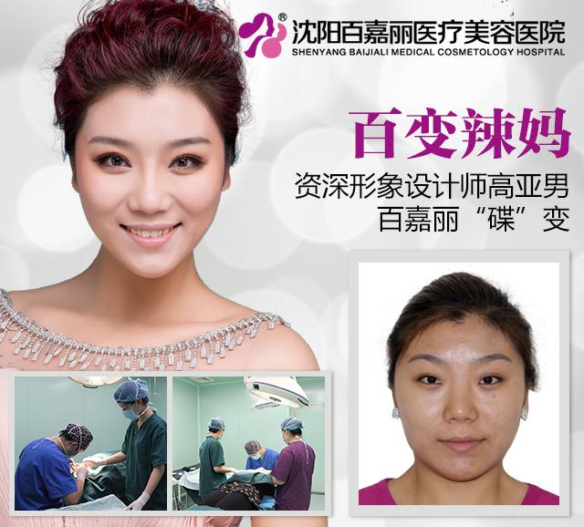 百嘉麗真人案例：高亞楠