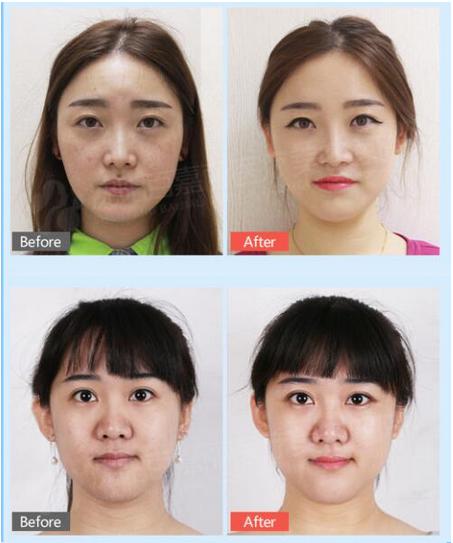 百嘉麗美白案例 帶您見證真實(shí)蝶變