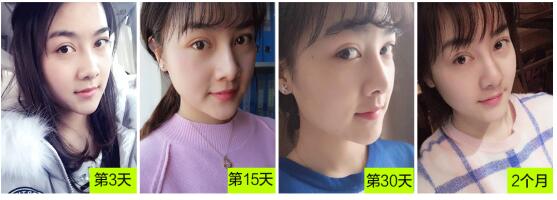 專家案例