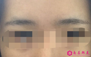 紋眉前