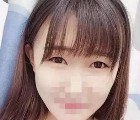 做了雙眼皮，變仙女了