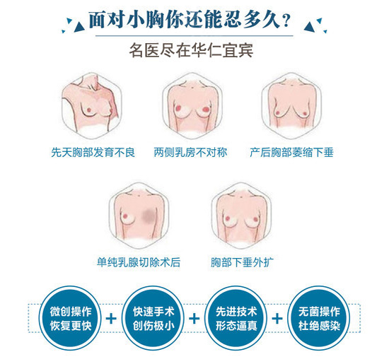 宜宾华仁假体隆胸 美国曼托圆形魅力版 无痕丰盈 宛若天生