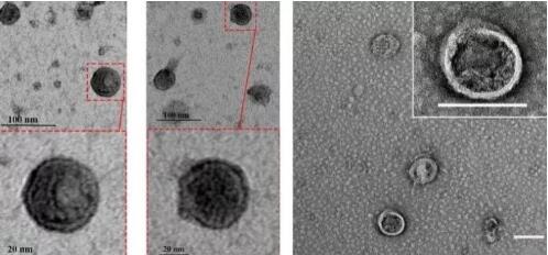 (图3:透射电镜观察下纳米微粒双重磷脂膜的囊泡)