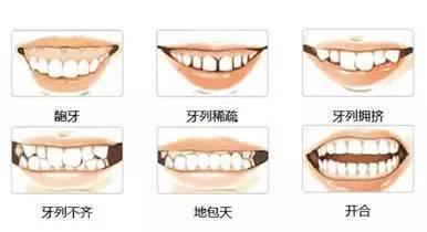 牙齿不齐的原因